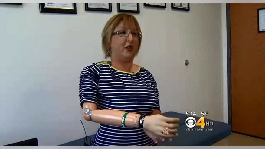 Bionic arm.jpg
